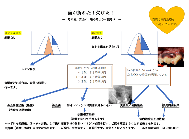 歯が折れた・欠けた場合の対応を示したフローチャート。エナメル質破折（露髄なし）はレジン修復、象牙質破折（露髄あり）は年齢に応じた緊急対応が必要です。歯科レントゲンで異常がなければ経過観察や生活歯の切断、神経まで達している場合は抜髄根管治療を行います。放置すると失活歯や歯髄感染、根尖病巣に進行する可能性があります。治療費は約5〜7万円。当院では歯内治療を行っております。連絡先は045-303-0076です。